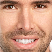 Cheap Veneers