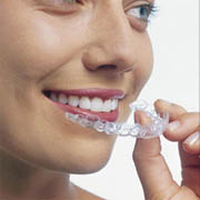 Invisalign Braces